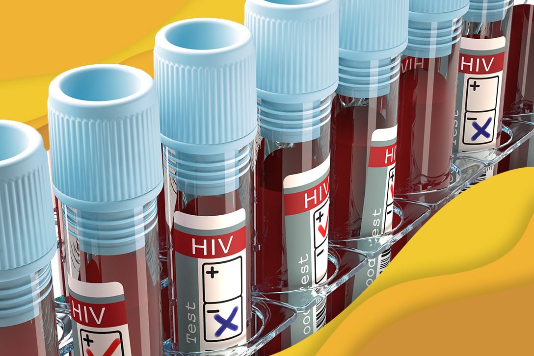 Patient-Care-and-Progress-for-Those-Diagnosed-with-HIV-and-AIDS-in-the-Past-Decade